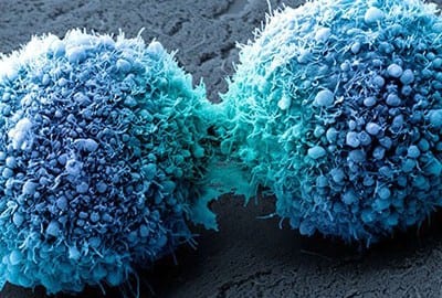 Smartphone cancer app slashes research time